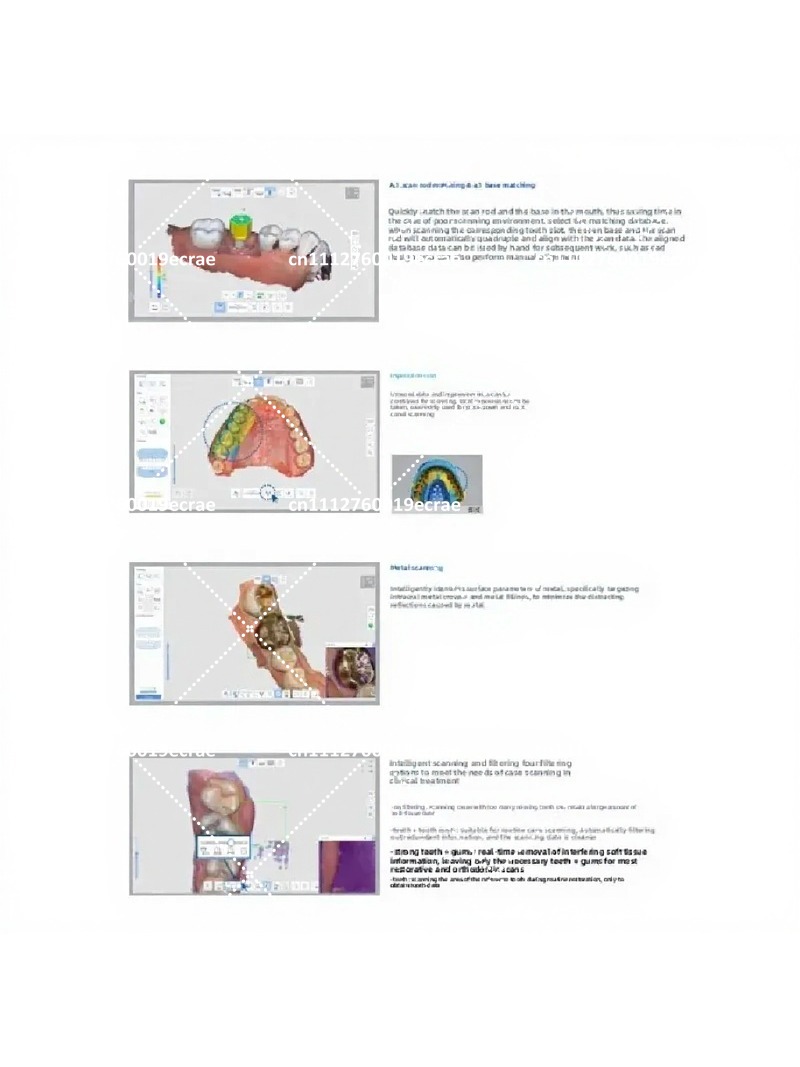 High-Quality Intraoral Scanner - Outdoor Furniture Quality ulasan dan harga